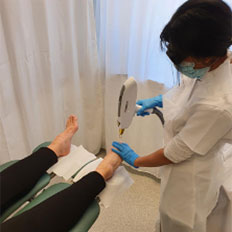Laser Treatment of Fungal Nails