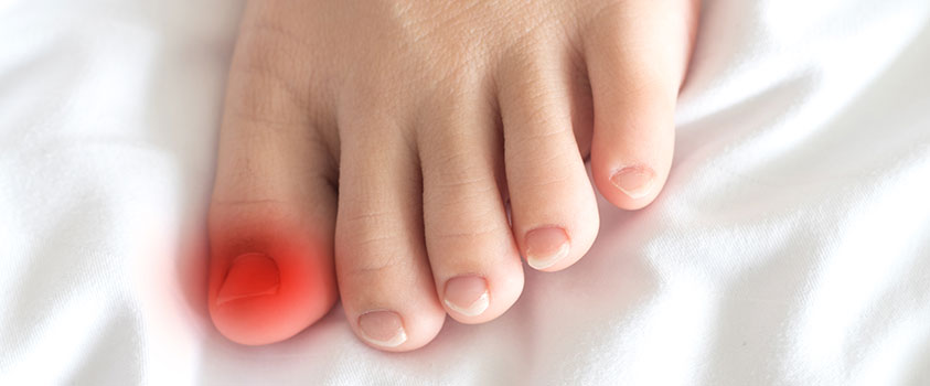 nail pain