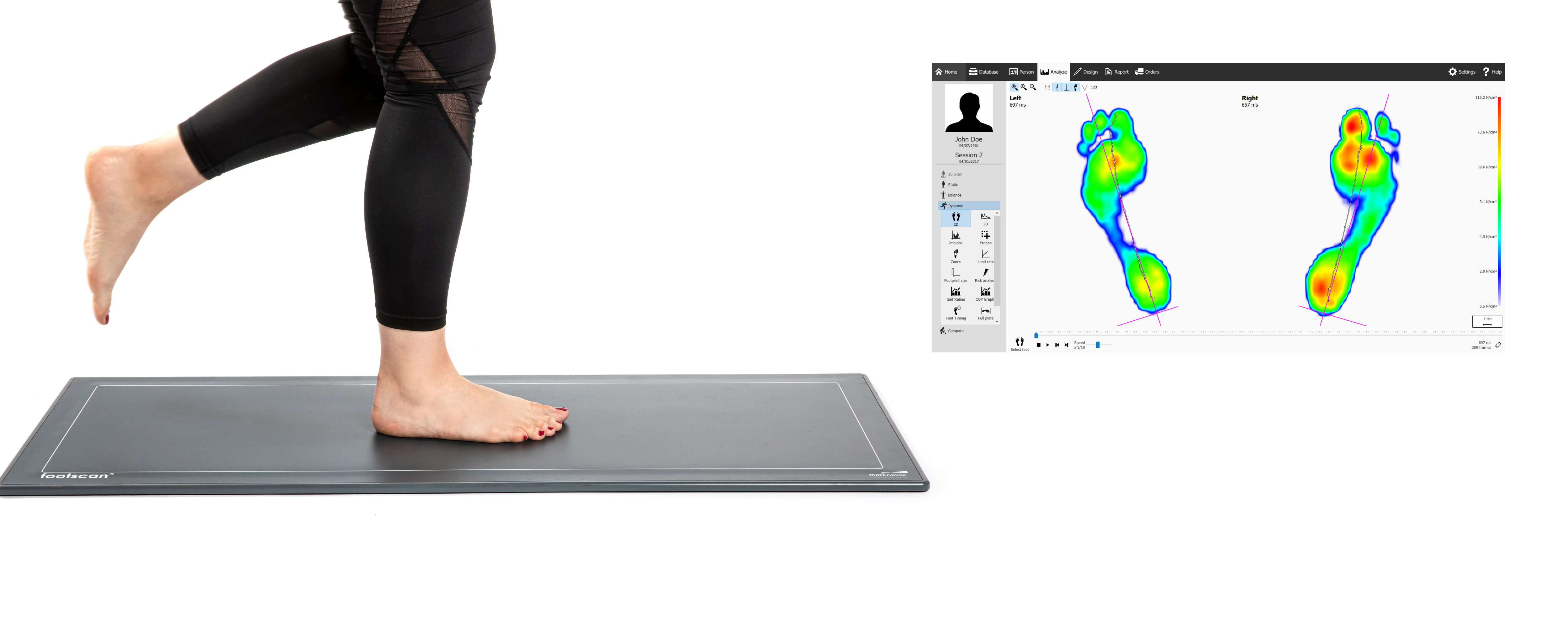 essex footcare footscan