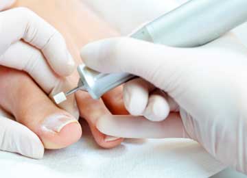 diabetic feet